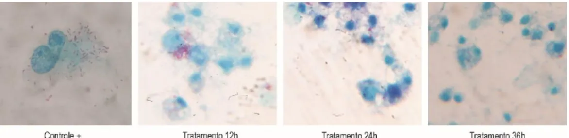 Figura  1.  Microscopia  óptica  de  monocamada  de  célula  Vero  infectadas  com  Rickettsia  rickettsii sem e com tratamento com doxiciclina na dosagem de 10mg