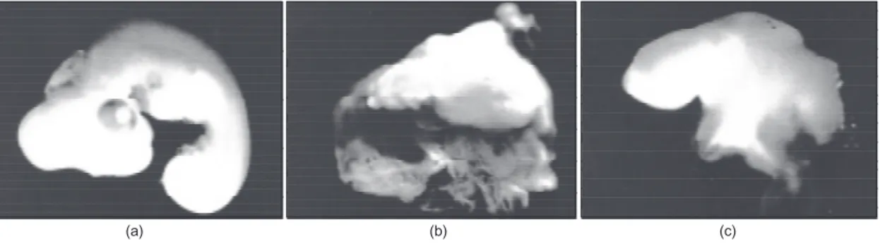 Fig. 1 — Embriões de Gallus gallus domesticus incubados a 37,5ºC por 96 horas. (a) Embrião normal (estádio 23); controle [29 x] (b), (c)