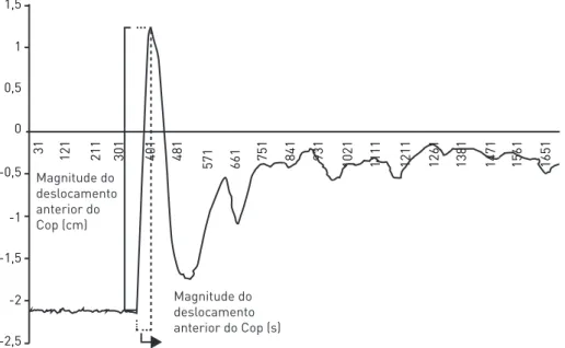 FIguRa 2 –  Representação do gráfico de deslocamento ântero-posterior do CoP para  teste de  perturbação do equilíbrio 