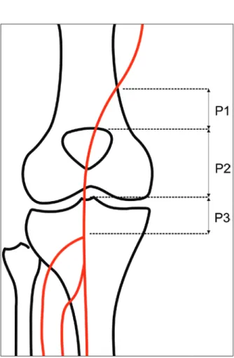 Figura 1. Representação esquemática dos segmentos da artéria poplítea. 