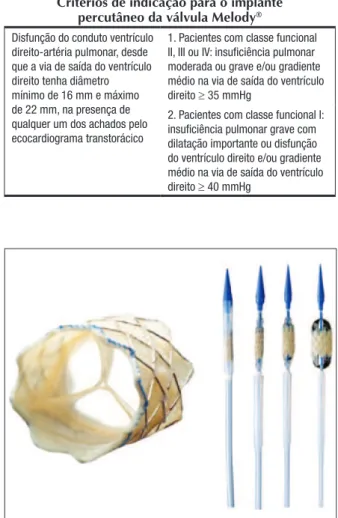 Figura 1. À esquerda, válvula Melody ®  aberta, evidenciando o arranjo  da veia jugular bovina suturada no interior do stent
