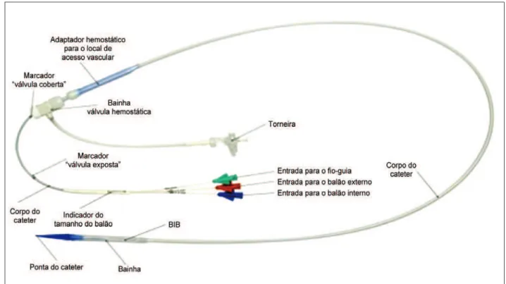 Figura 2. - Sistema de entrega (Ensemble ® ) desenvolvido especificamente para implante da válvula Melody ® 