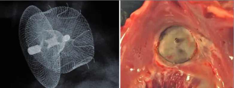 Figura 2 - Aspecto do dispositivo em estudo experimental em animal. À esquerda, integridade da prótese depois de ter sido explantada 90 dias após o implante (técnica Faxitron)