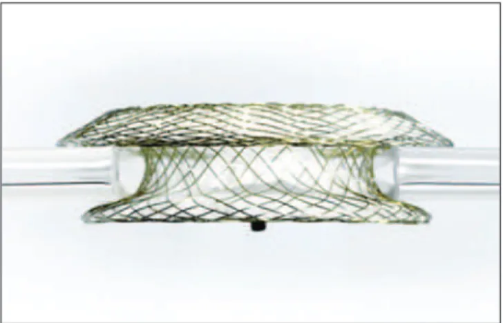 Figura 1 - Prótese Figulla tamanho 30 mm. Nota-se a rede de nitinol formando dois discos conectados pela cintura central de 30 mm