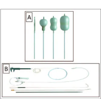 Figura 1 - Em A, novo balão “tipo Inoue” sendo progressivamente insuflado, observando-se que a porção distal infla antes que a proximal