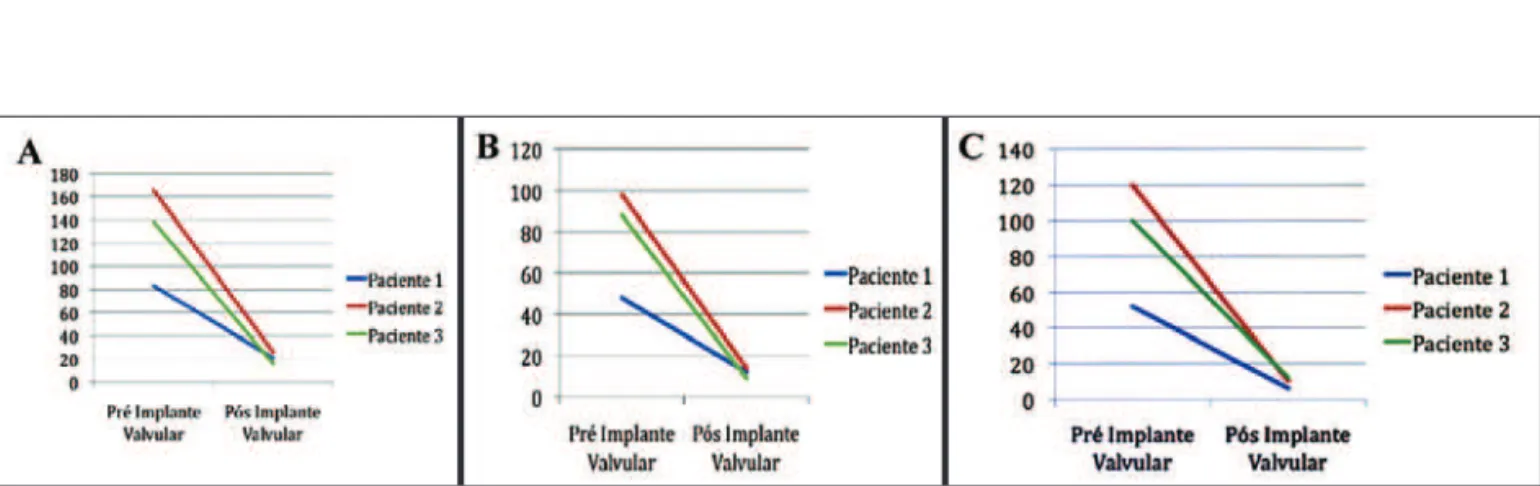 Figura 8 - Variação gráfica dos gradientes pressóricos em milímetros de mercúrio (mmHg) entre o ventrículo esquerdo e a aorta: (A) gradientes máximos pré e pós-implante medidos pela ecocardiografia; (B) gradientes médios pré e pós-implante medidos pela eco