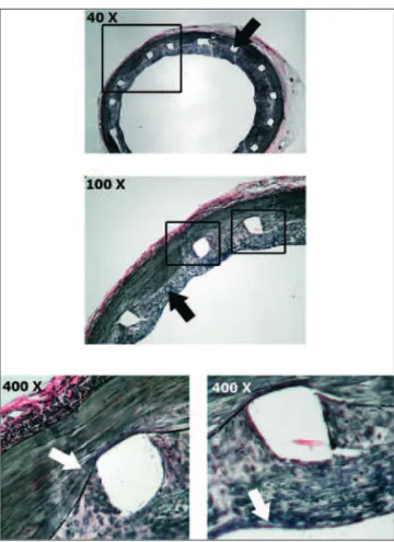 Figura 8 - Corte transversal de artéria coronária com stent-teste de cobalto-cromo um mês após o implante em modelo porcino