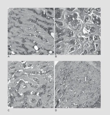 FIGURA 1 – Osso esponjoso (trabecular) do terço proximal de fêmur de ratas.HE.100X. A, Grupo Controle (G1).