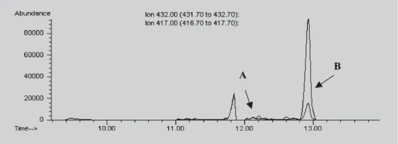 FIGURA 1 - Perfil cromatográfico da análise de uma amostra de urina de um indivíduo adulto, do sexo masculino, não usuário de esteróides anabólicos