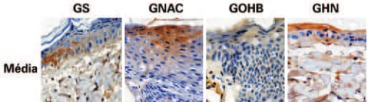 Figura 4 – Fotomicrograias dos grupos GS, GNAC, GOHB e  GHN, demonstrando a expressão de caspase 3 (cor marrom) 