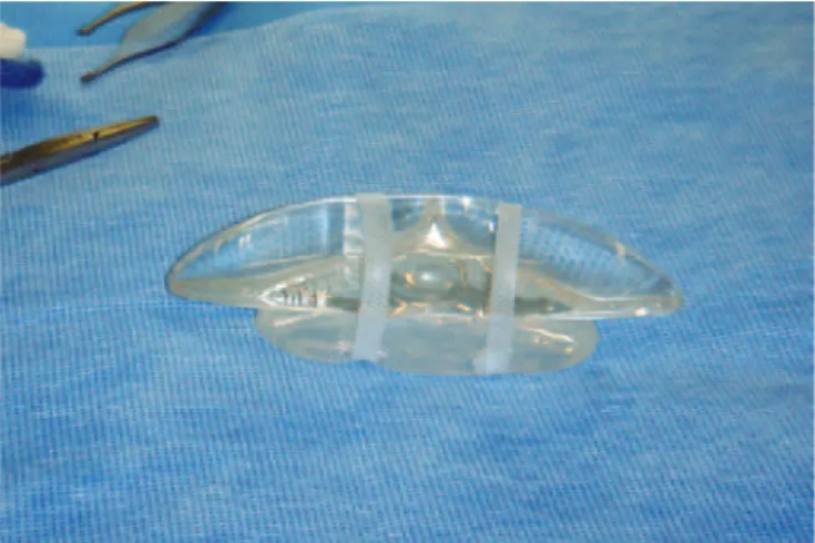 Figura 8 – União dos implantes de gel  e elastômero com ita de silicone.
