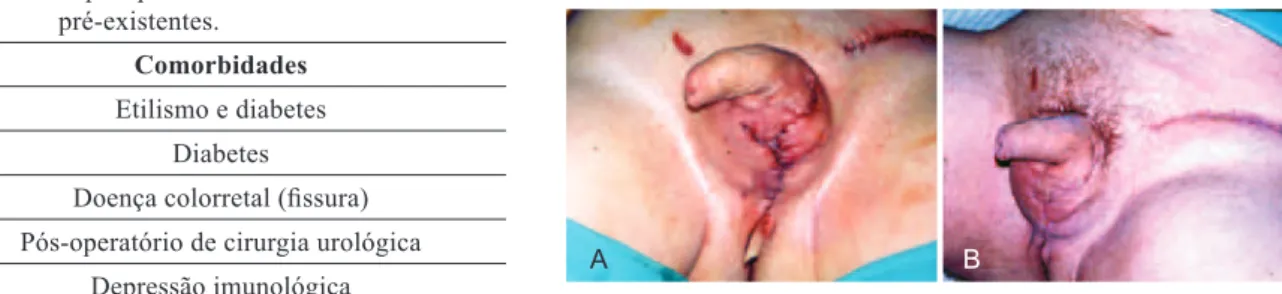 Figura 3 – Pré-operatório de reconstrução de bolsa escrotal   após curativos de antimicrobianos tópicos