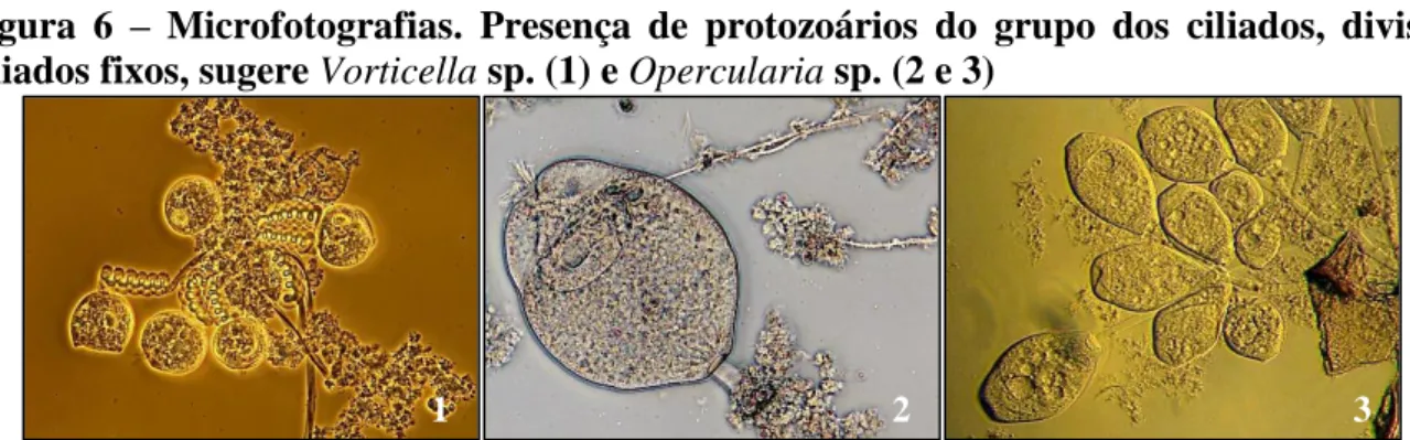 Figura  6  –  Microfotografias.  Presença  de  protozoários  do  grupo  dos  ciliados,  divisão  ciliados fixos, sugere Vorticella sp