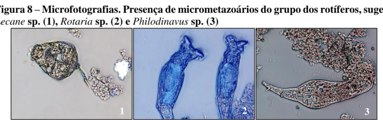 Figura 8 – Microfotografias. Presença de micrometazoários do grupo dos rotíferos, sugere  Lecane sp