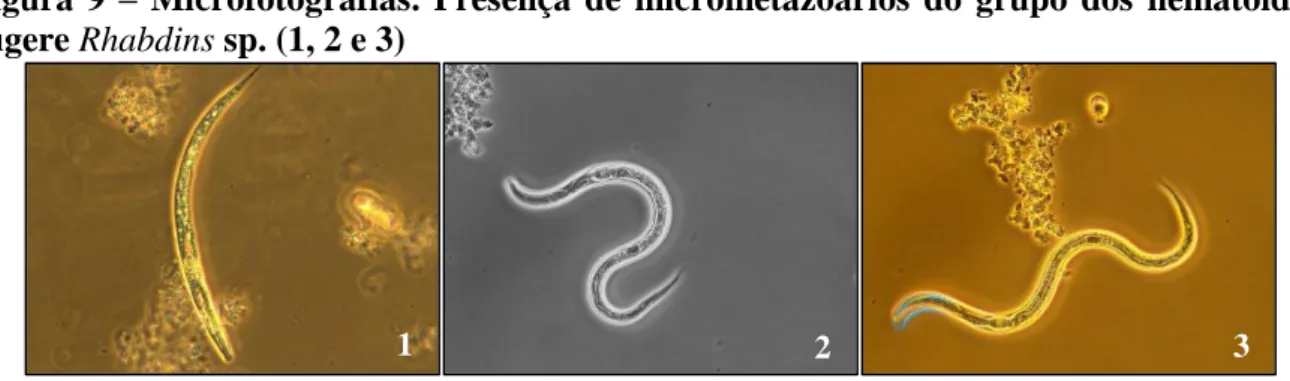Figura  9  –  Microfotografias.  Presença  de  micrometazoários  do  grupo  dos  nematóides,  sugere Rhabdins sp