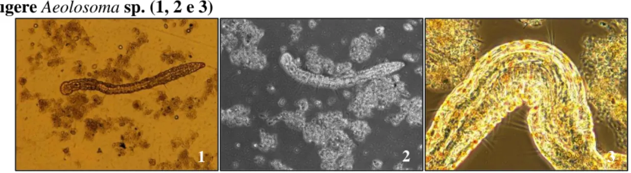 Figura  10  –  Microfotografias.  Presença  de  micrometazoários  do  grupo  dos  anelídeos,  sugere Aeolosoma sp