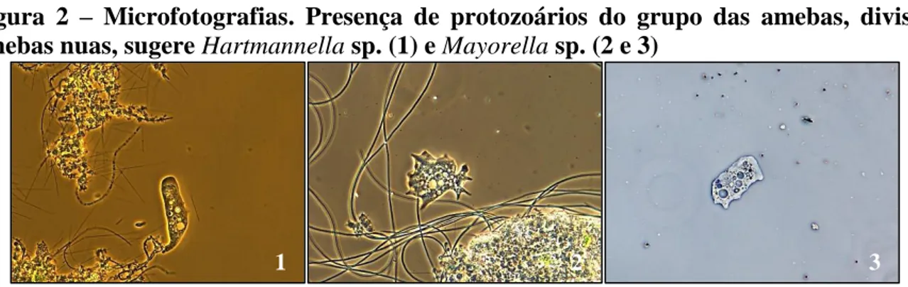 Figura  2  –  Microfotografias.  Presença  de  protozoários  do  grupo  das  amebas,  divisão  amebas nuas, sugere Hartmannella sp