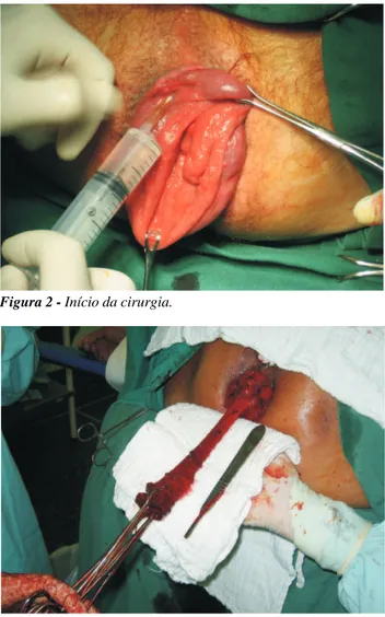 Figura 2 - Início da cirurgia.