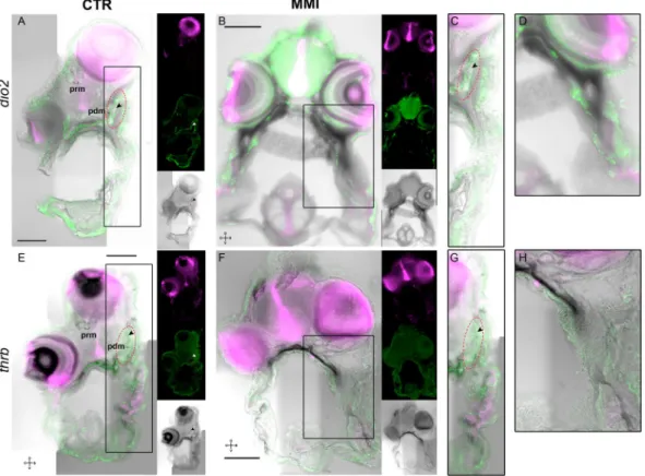 Figure 5.  Thyroid dependent asymmetric expression of dio2 and thrb demarks a TH-responsive asymmetric  centre responsible for bone ossification, eye migration and asymmetric head development during sole  metamorphosis