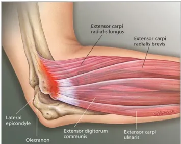 Figura 1: Músculos extensores do antebraço in Rheumatology network,2010 (7) 