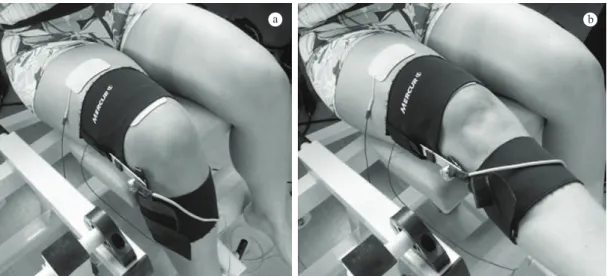 Figure 1. Biomechanical model to estimate the force (Fm) applied  by the quadriceps muscle group during movement of knee extension,  where the angle θ is deined as the complement of the angular  variation associated with FES, mg is the weight of the segmen
