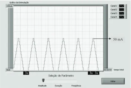 Figura 4. Exemplo de peril de FES criado no programa de interface com o usúrio do equipamento FES-PEB