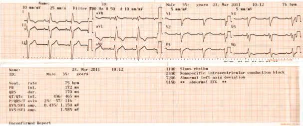 Table 5. Results of automated electrocardiograph diagnosis for   patients, by diagnostic category.