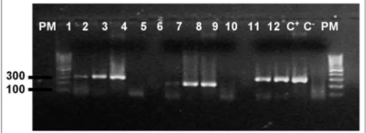 Tabela 1. Amplificação do gene beta-globina e genoma do EBV nas  tonsilas avaliadas.
