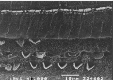 Figura 3. Microscopia eletrônica de varredura de um animal do grupo 3  (tratado com cisplatina e EA), com lesão extensa das CCEs, na porção  basal da cóclea