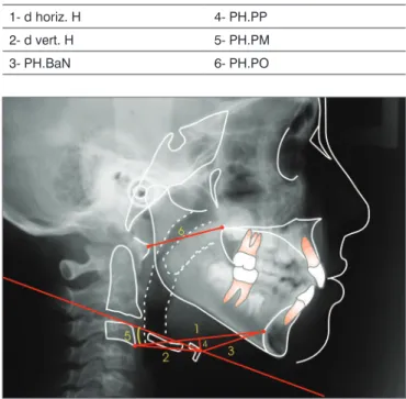 Figura  2.  Grandezas  cefalométricas  para  determinar  a  posição  do  osso hióide.