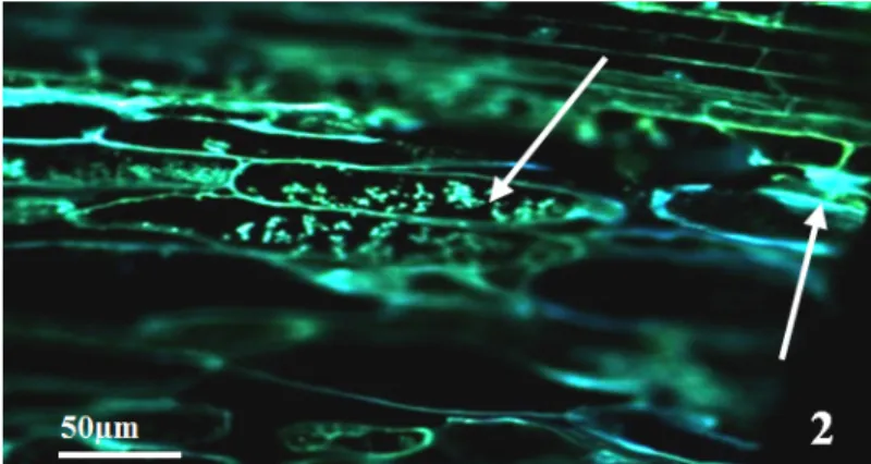 Fig. 2. α-cinnamomin treated roots. (FM) - Autofluorescence of phenol-like deposits  (arrows) in the vacuoles and along cell walls of the cortical parenchyma