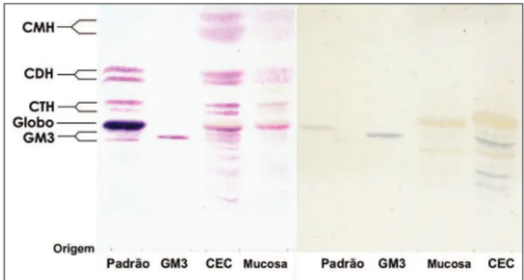 Figura 1. Lâmina de HPTLC corada com orcinol/H2SO4. (esquerda)  e (direita) HPTLC corada com resorcino - Padrão - Padrão de GSLs  de eritrócitos