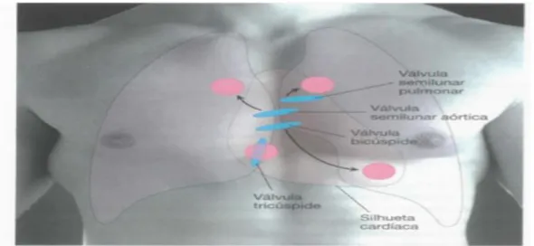 Figura  11.  Pontos  de  auscultação  das  válvulas  cardíacas  na  parede  anterior  do  torax  