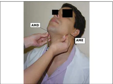 Figura 1. Marcação da medida do ângulo da mandíbula direito (AMD) ao ângulo esquerdo (AME).
