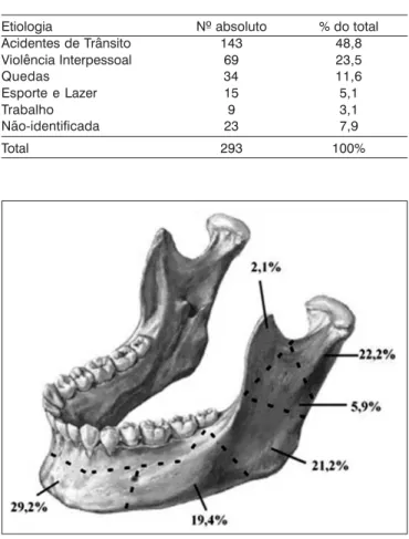 Tabela 1. Distribuição das reduções de fratura de mandíbula segundo etiologia, HC-UFU, 1974-2002.