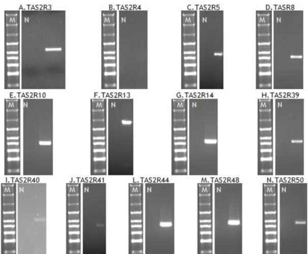 Figura  9  –  Eletroforese  em  gel  de  agarose  a  1%,  corado  com GreenSafe,  dos  produtos  de  RT-PCR,  realizado com cDNA de HIBCPP