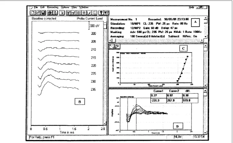 Figura 4: Painel A: Parâmetros de estimulação e registro utilizados para medida do ECAP no eletrodo 10 e nível de estimulação igual a 235.