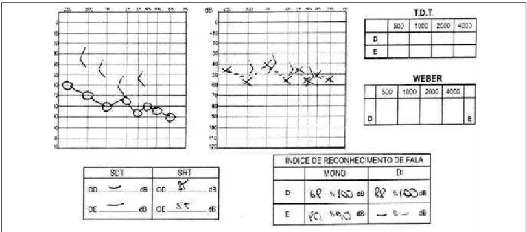 Figura 1. Audiometria tonal e vocal.