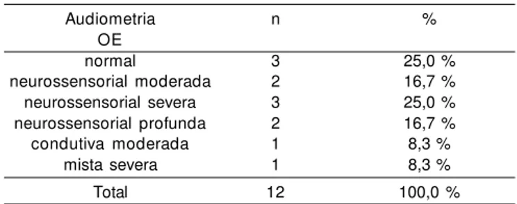 Tabela IV. Distribuição dos sujeitos de acordo com o resultado da audiometria da orelha esquerda.