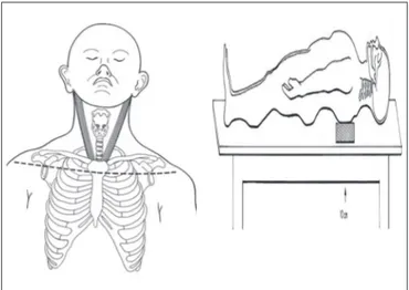 Figura  1.  Esquema  representando  a  posição  do  cadáver  para dissecção (o ângulo formado entre o plano horizontal e a mandíbula é  de  95º).