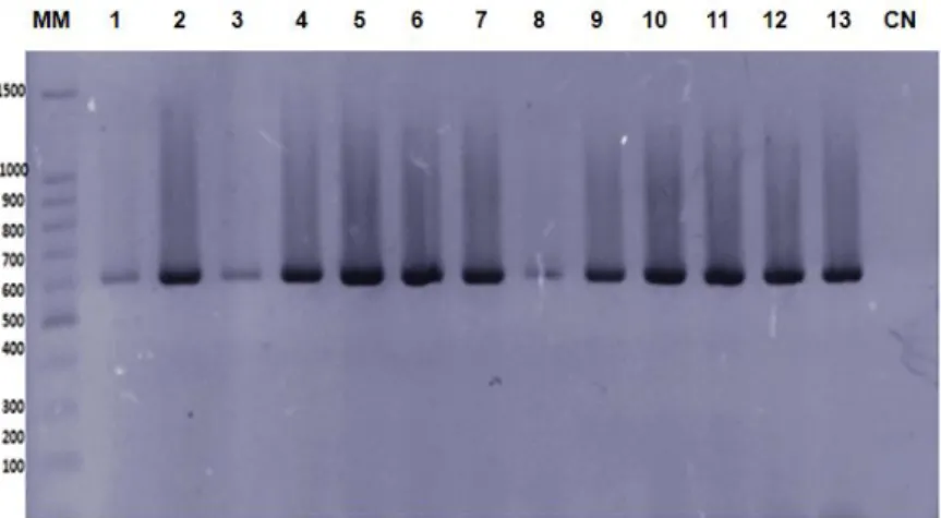 Figure 2. Specific profile for chikungunya virus obtained by one-step RT-PCR assay using as a template the RNA  extracted from some sera samples 