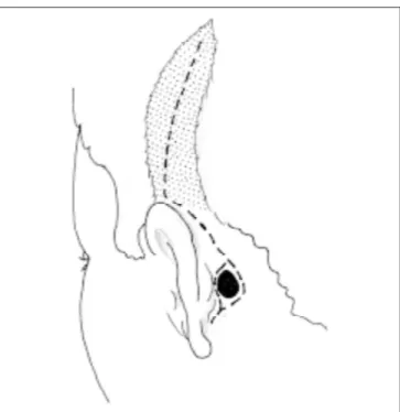 Figura 1. Esquema da rica vascularização da gálea aponeurótica e seus pedículos principais (ATS) artéria temporal superficial e (AO) artéria occiptal.