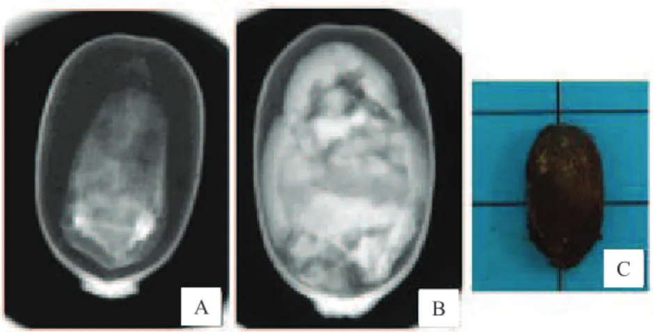 Figura 3. Imagens radiográi cas de sementes de mamona classii cadas como parcialmente cheia e translúcida - PCT (A) e  parcialmente cheia com defeito no embrião - PCDE (B), resultando em uma semente morta (C)