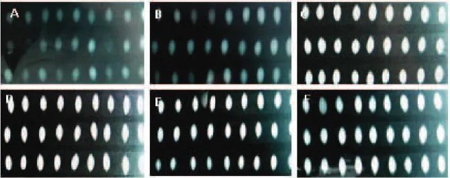 FIGURA 3. Imagem interna de sementes de pepino, pelo teste de raios- x, em diferentes idades de maturação