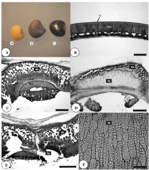 FIgURA 1.  Características da testa e do hilo da semente de  Adesmia tristis . A. Variação na coloração da testa da semente: 