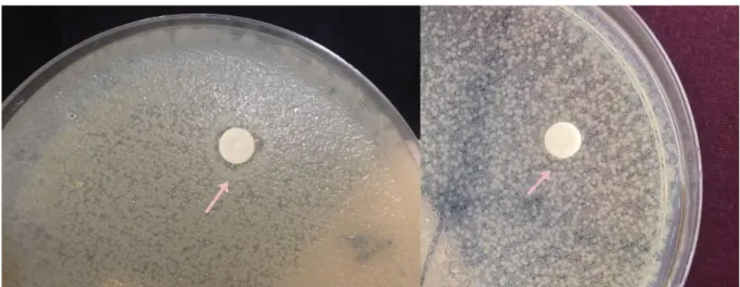 Figura 4: Análise qualitativa do leite maduro antes (4A) e após (4B) o processo de pasteurização em cepas de  Escherichia coli 