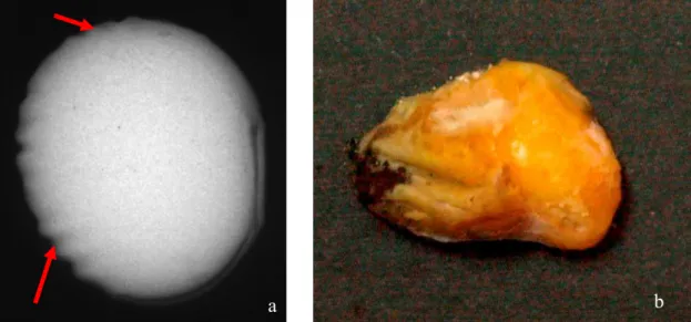 FIGURA  4.  Imagem  de  semente  obtida  por  meio  do  teste  de  raios  X,  apresentando  dano  por  “umidade”  severo  na  região dos cotilédones e no eixo embrionário (a), originando uma plântula anormal (b).