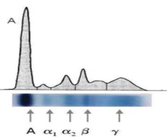 Figura 3. Principais proteínas encontradas em cada fracção electroforética (5). 