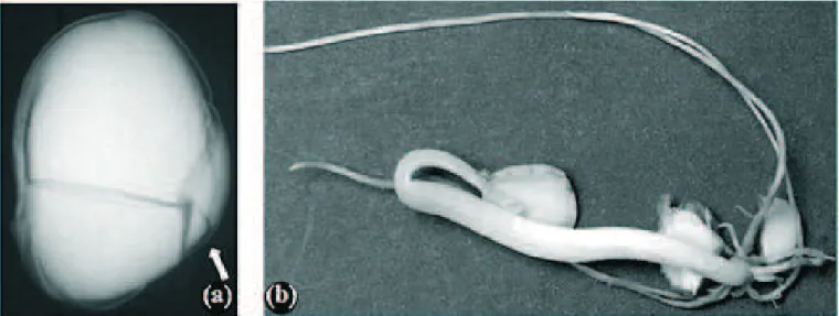 figUrA 3.   semente submetida a um impacto a 965,3Kpa, resultando em dano mecânico severo nos cotilédones e eixo  embrionário; imagem de raios X (a) e fotograia da plântula anormal resultante (b).