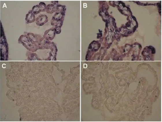 Figure  5: ISH  using  a  specific  rat  AR  cRNA  riboprobe.  High  levels  of  AR  expression  were  detected in the cytoplasm of male and female rat CPs epithelial cells